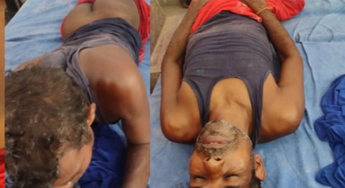 पुलिस पिटाई से जख्मी युवक पुलिस पिटाई से जख्मी युवक