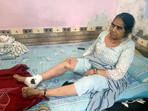 घायल महिला विमला, जिसे सांड ने पटक दिया। घायल महिला विमला, जिसे सांड ने पटक दिया।