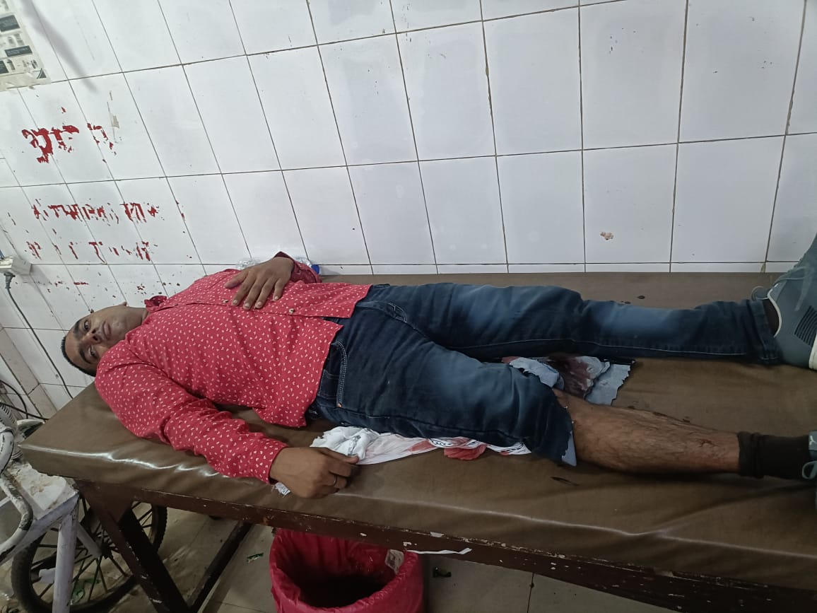 सुलतानपुर मे सर्राफा डकैती के तीन आरोपित पुलिस मुठभेड में घायल घायल , गिरफ्तार सुलतानपुर मे सर्राफा डकैती के तीन आरोपित पुलिस मुठभेड में घायल घायल , गिरफ्तार