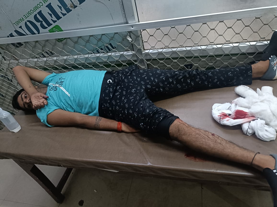 सुलतानपुर मे सर्राफा डकैती के तीन आरोपित पुलिस मुठभेड में घायल घायल , गिरफ्तार सुलतानपुर मे सर्राफा डकैती के तीन आरोपित पुलिस मुठभेड में घायल घायल , गिरफ्तार