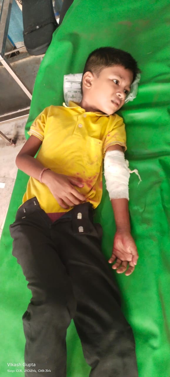 घायल बच्चे घायल बच्चे