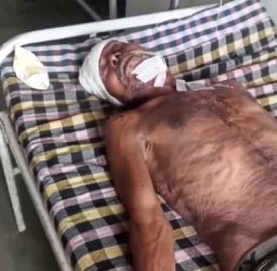 छतरपुर : लेनदेन के विवाद पर अधेड काे मारी गाेली , गंभीर हालत में भर्ती छतरपुर : लेनदेन के विवाद पर अधेड काे मारी गाेली , गंभीर हालत में भर्ती