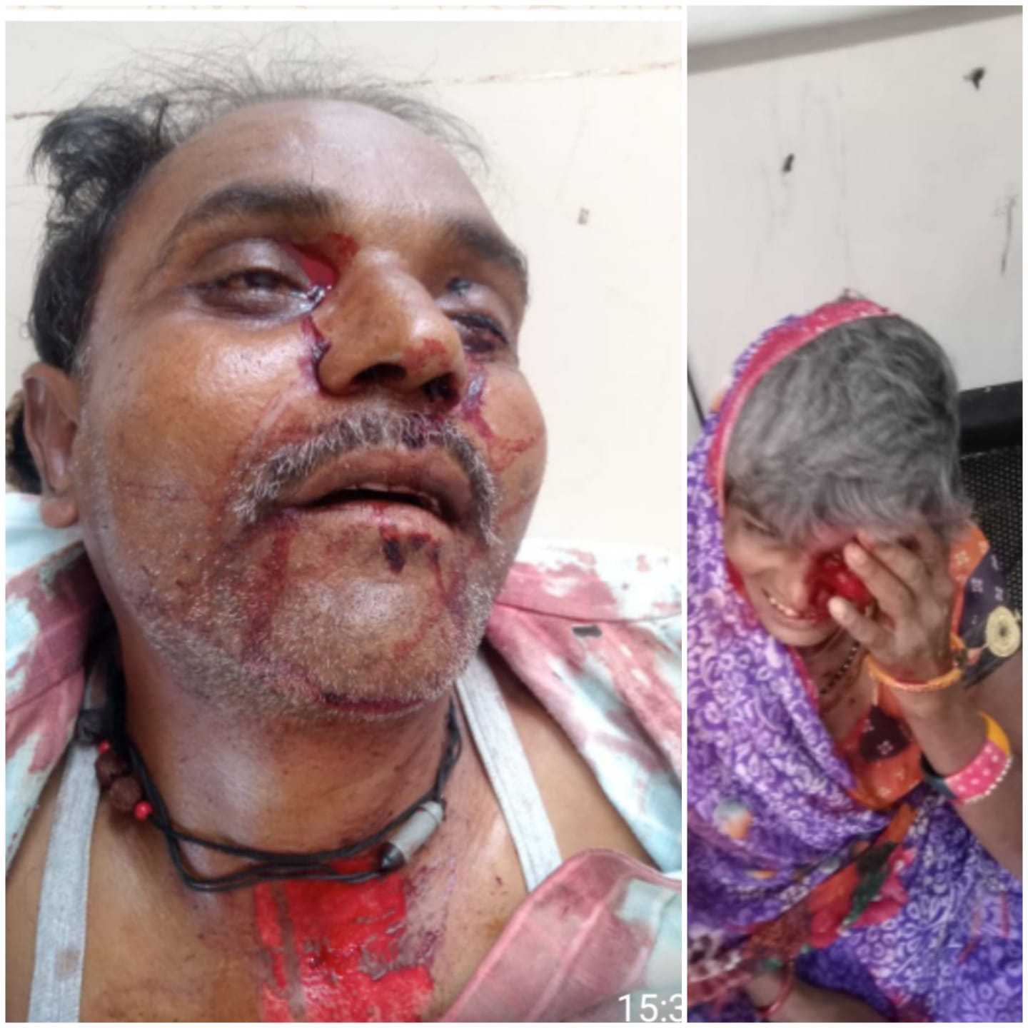 , एक व्यक्ति की मौत महिला घायल , एक व्यक्ति की मौत महिला घायल