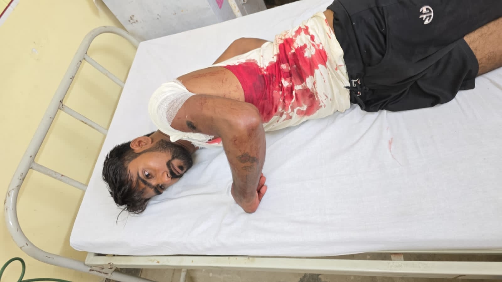 घायल रितेश घायल रितेश