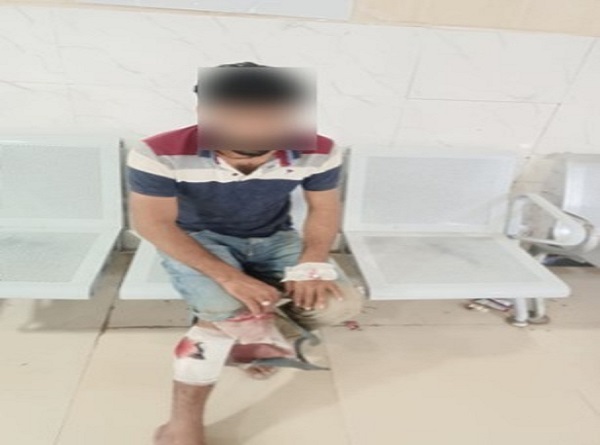 पुलिस की गोली से घायल बदमाश अस्पताल में इलाज कराते हुए पुलिस की गोली से घायल बदमाश अस्पताल में इलाज कराते हुए