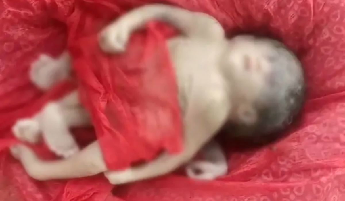 अररिया में 4 हाथ-पैर वाले बच्चे का जन्म, ग्रामीण कर रहे पूजा अर्चना अररिया में 4 हाथ-पैर वाले बच्चे का जन्म, ग्रामीण कर रहे पूजा अर्चना