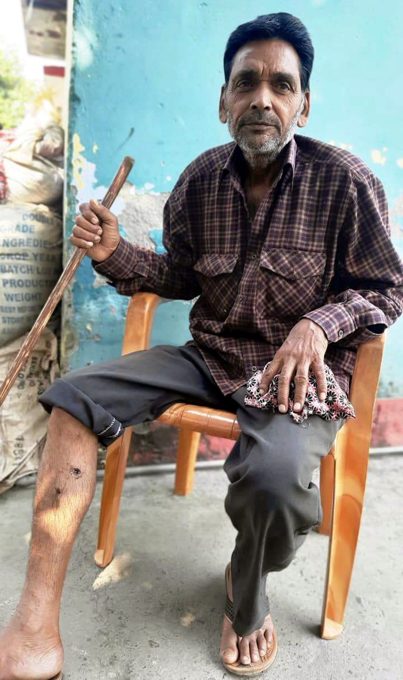 चिकित्सालय में रैबीज का इंजेक्शन न लगने से परेशान रमेश चंद्र। चिकित्सालय में रैबीज का इंजेक्शन न लगने से परेशान रमेश चंद्र।