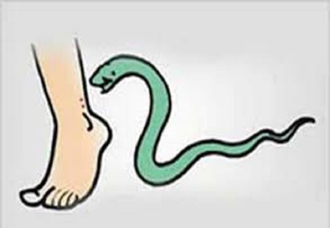 सांकेतिक फोटो—सर्प ने डसा
