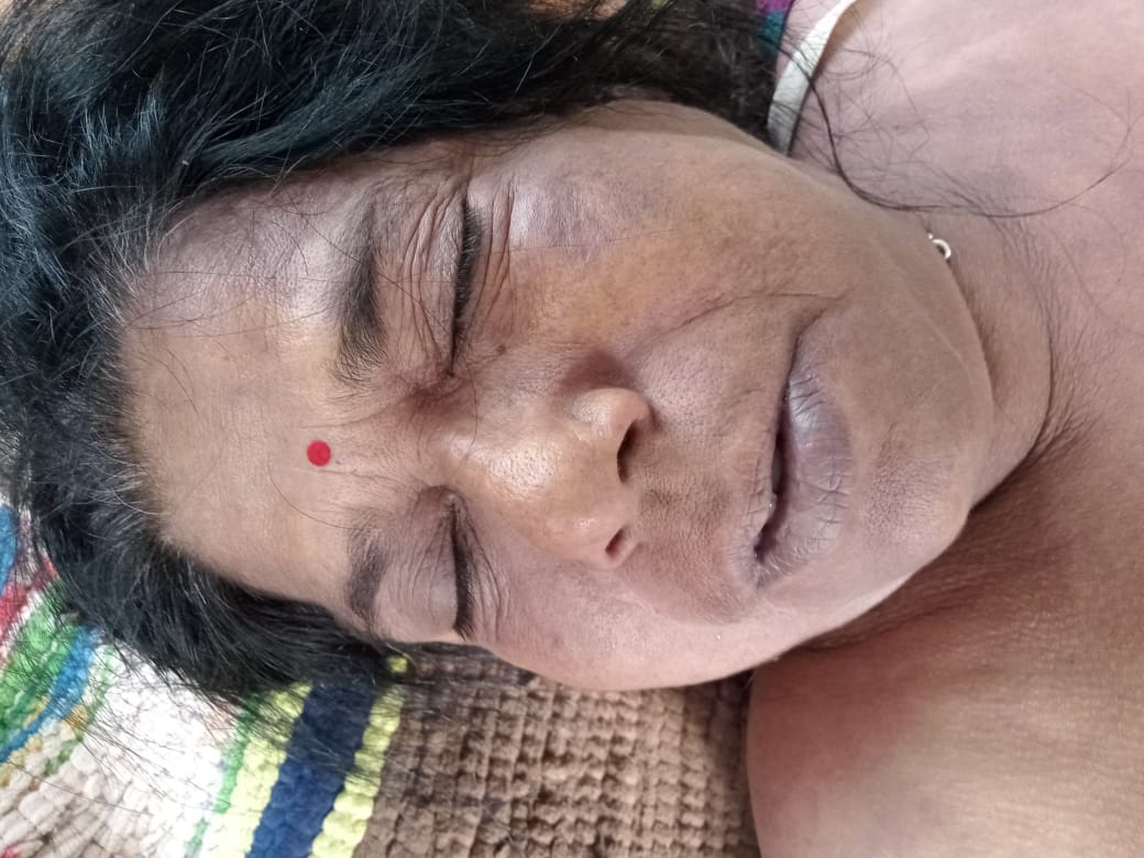 पदस्थ महिला कर्मचारी की मौत पदस्थ महिला कर्मचारी की मौत