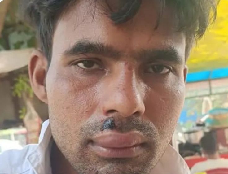 मृतक अक्षय मृतक अक्षय