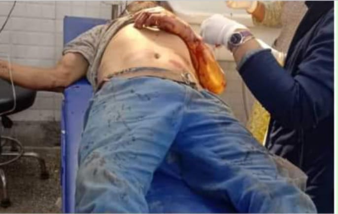 एक गंभीर घायल को हायर सेंटर किया रेफर एक गंभीर घायल को हायर सेंटर किया रेफर