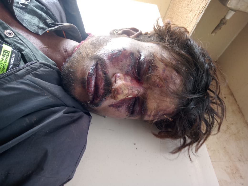 युवक का शव,परिजनों ने लगाए हत्या के आरोप युवक का शव,परिजनों ने लगाए हत्या के आरोप
