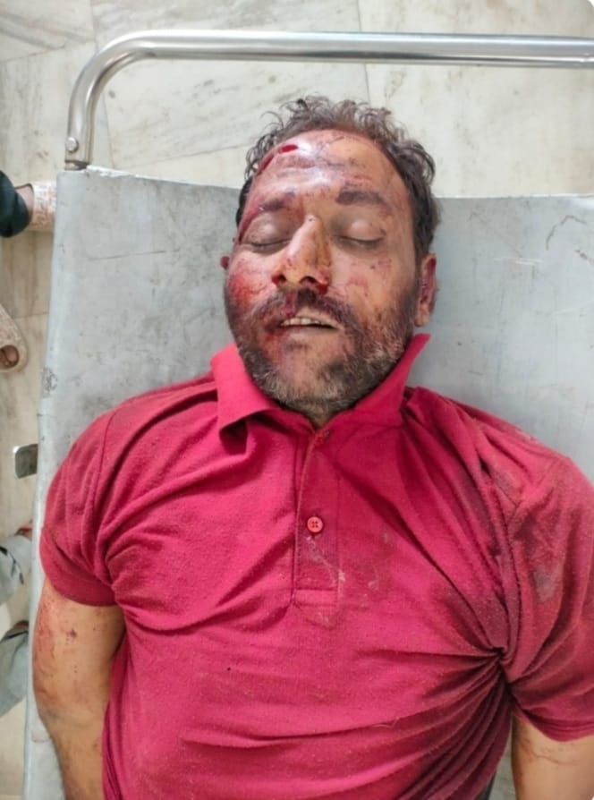 हाइवे क्राॅस कर रहे युवक की मौत हाइवे क्राॅस कर रहे युवक की मौत