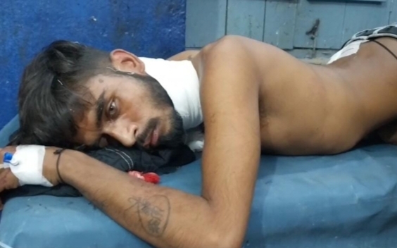 घायल युवक घायल युवक