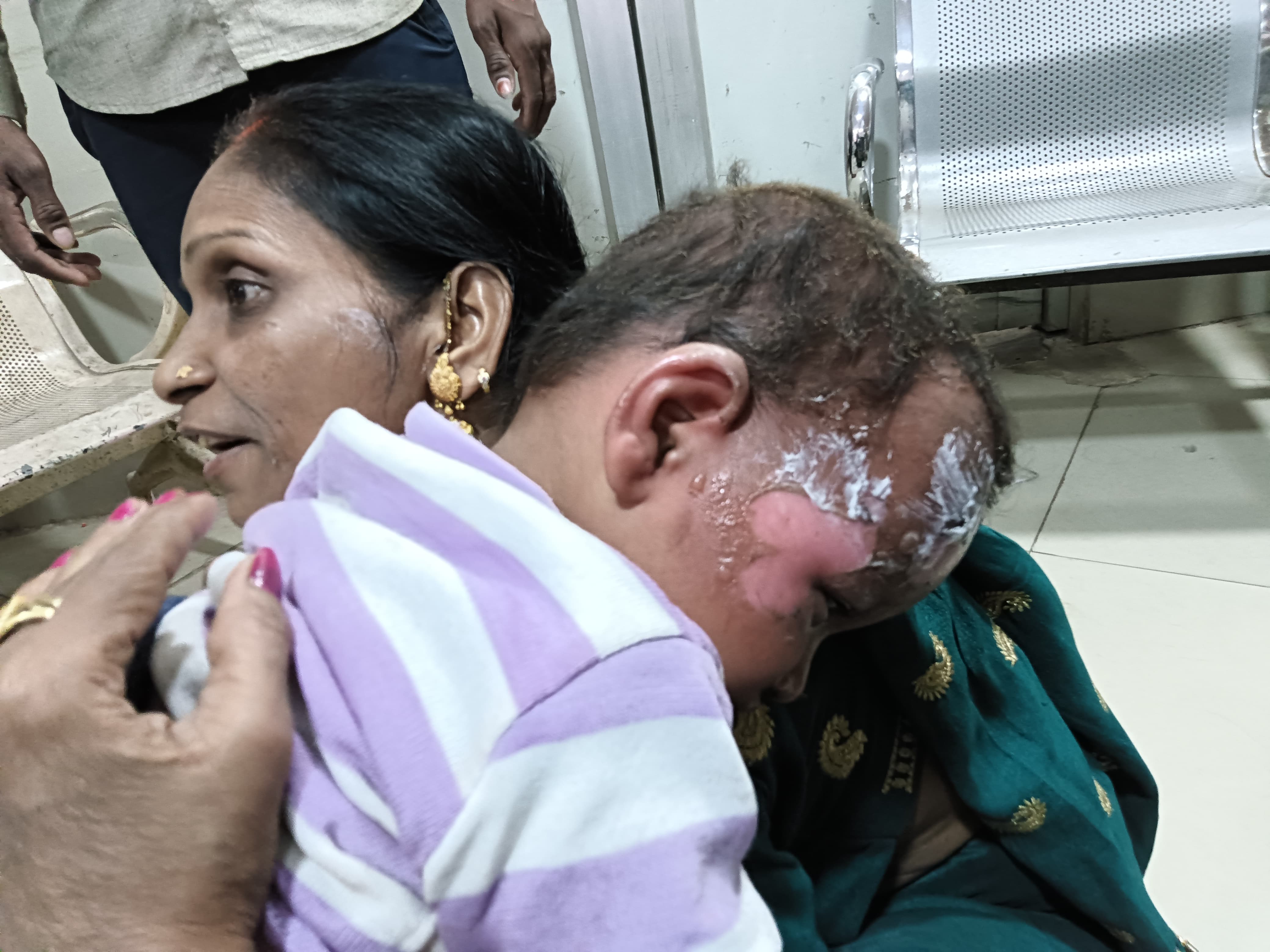 हादसे में झुलसी महिलाएं और बच्चे: फोटो बच्चा गुप्ता हादसे में झुलसी महिलाएं और बच्चे: फोटो बच्चा गुप्ता