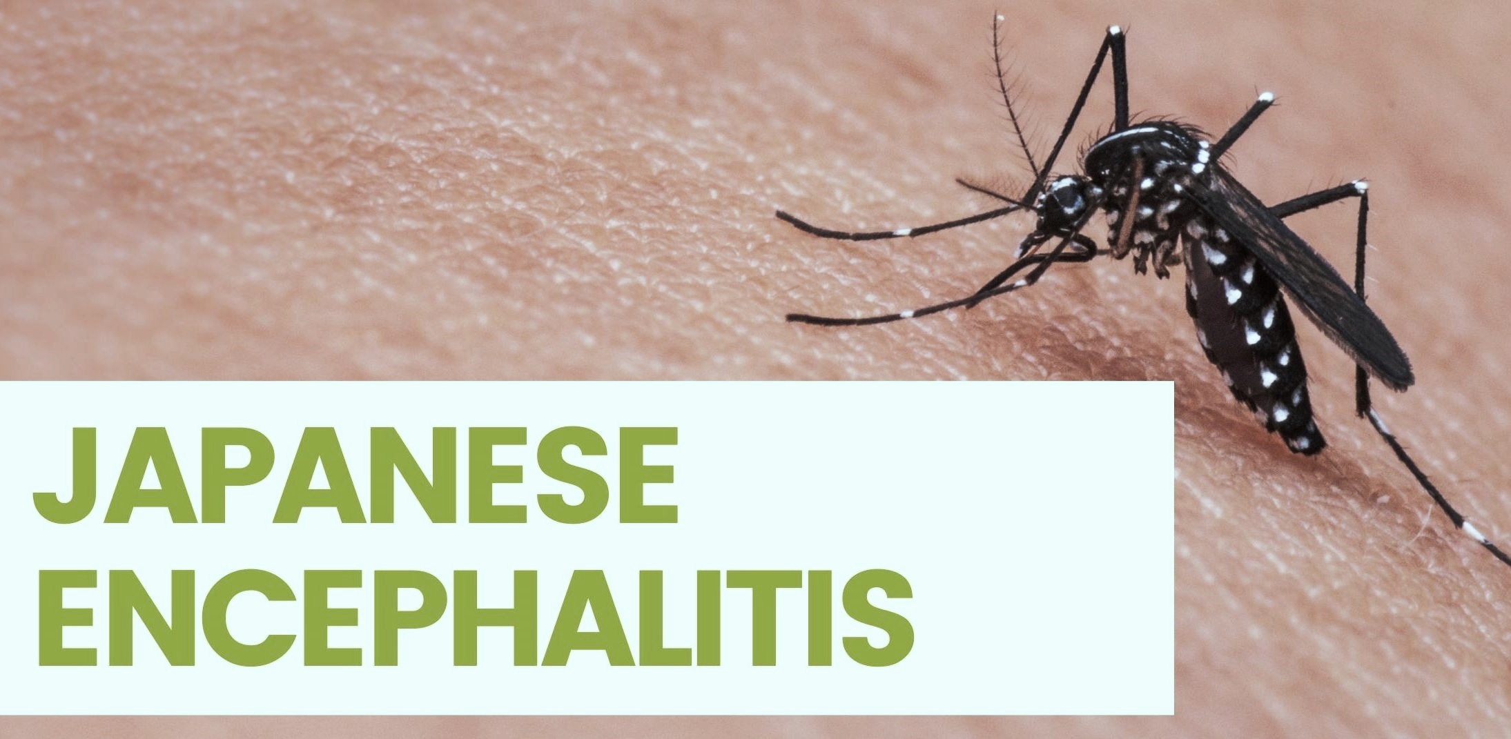 Japanese Encephalitis was reported in Delhi Japanese Encephalitis was reported in Delhi