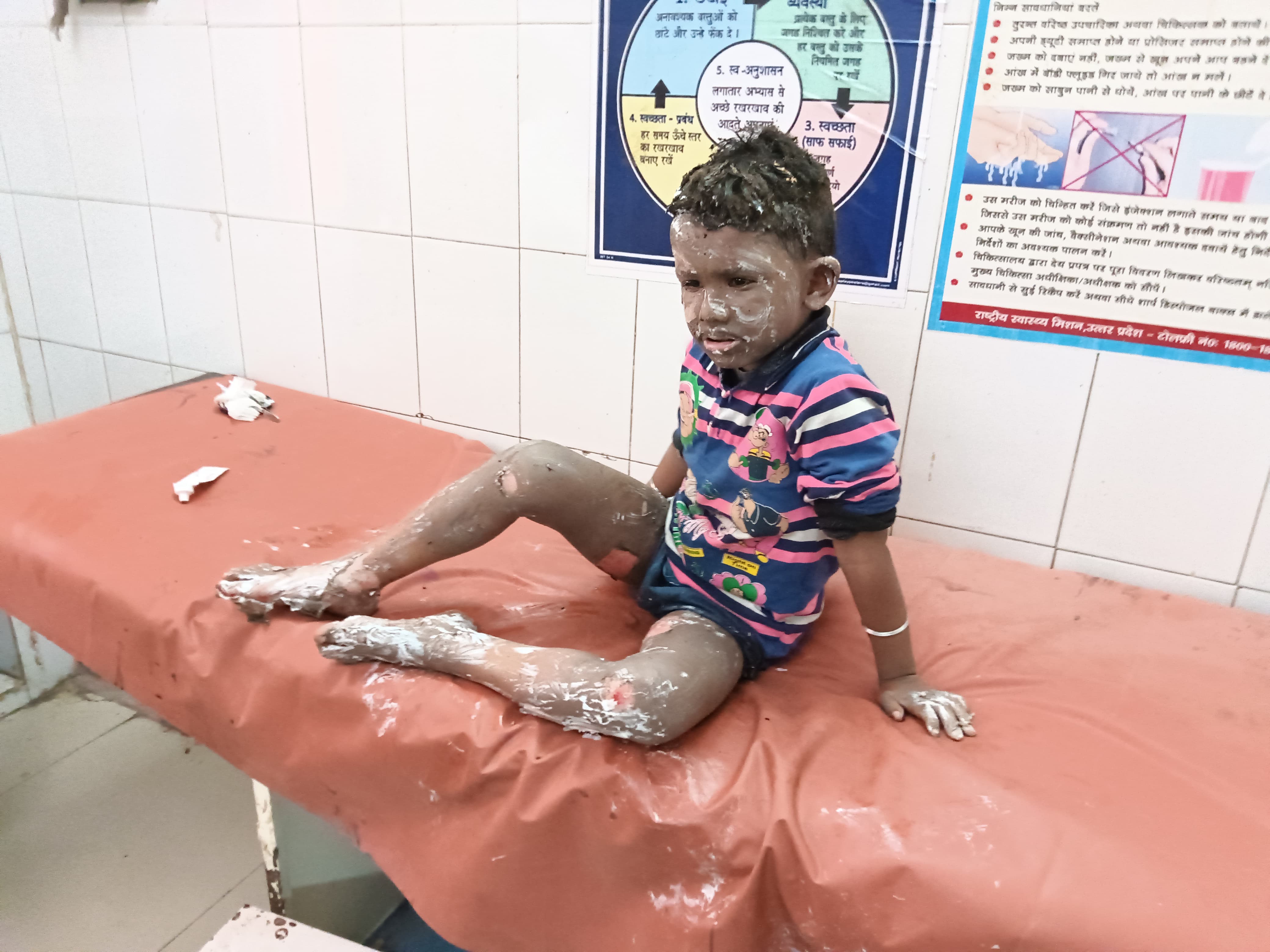 हादसे में झुलसी महिलाएं और बच्चे: फोटो बच्चा गुप्ता हादसे में झुलसी महिलाएं और बच्चे: फोटो बच्चा गुप्ता
