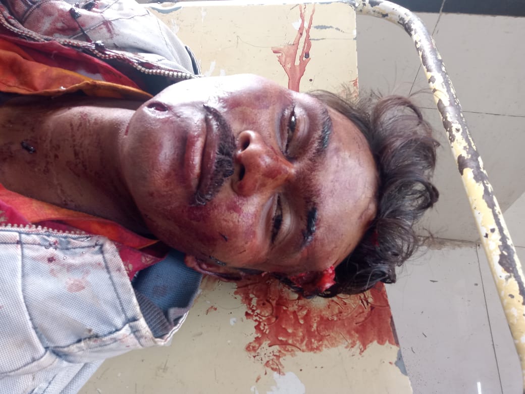 बाइक सवार एक युवक की मौत एक घायल बाइक सवार एक युवक की मौत एक घायल
