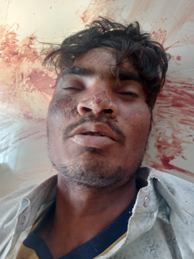 फांसी लगाकर की खुदकुशी, जांच शुरु फांसी लगाकर की खुदकुशी, जांच शुरु