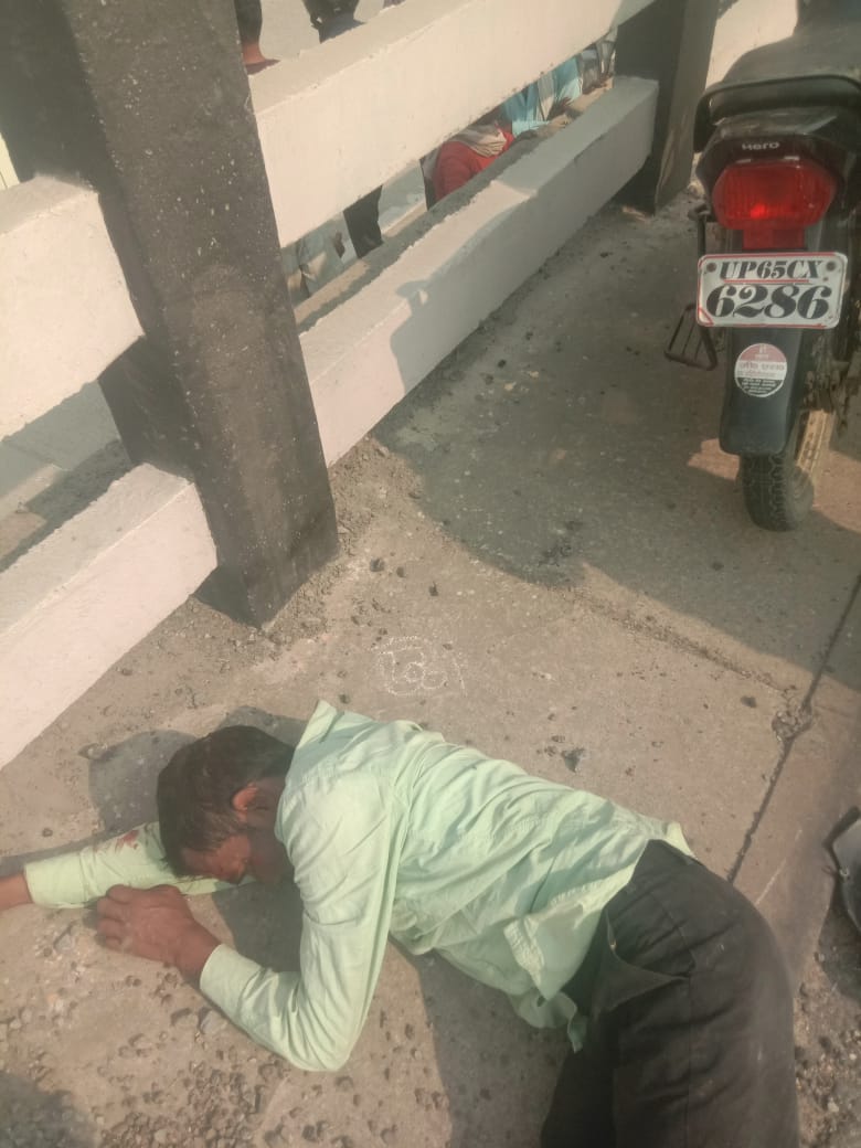 हादसे में घायल: फोटो बच्चा गुप्ता हादसे में घायल: फोटो बच्चा गुप्ता