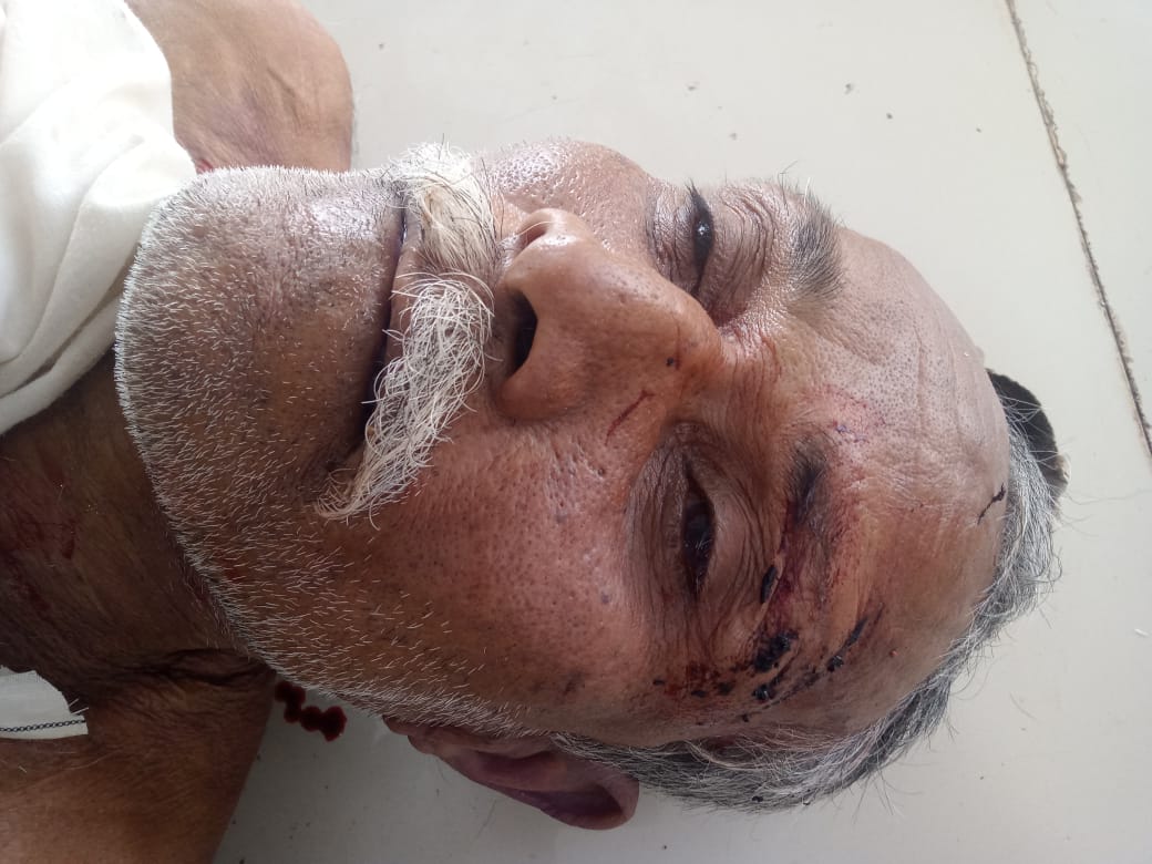 मरीज की बाथरुम में गिरने से मौत मरीज की बाथरुम में गिरने से मौत