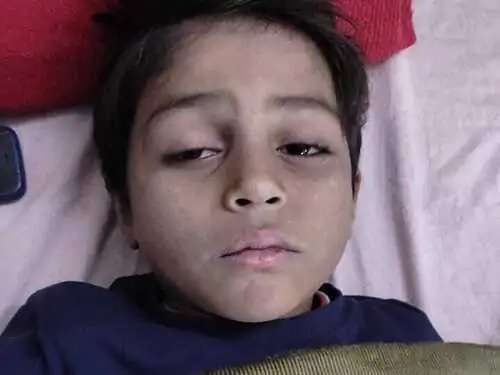पीड़ित बच्चा। पीड़ित बच्चा।