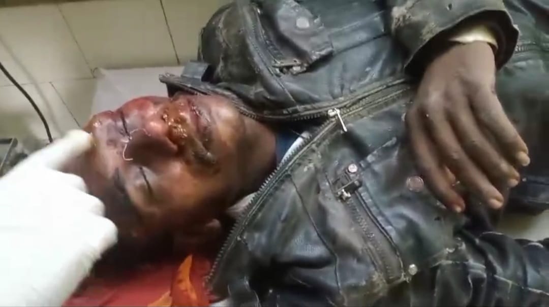 फिसलने से युवक घायल, हालत गंभीर फिसलने से युवक घायल, हालत गंभीर