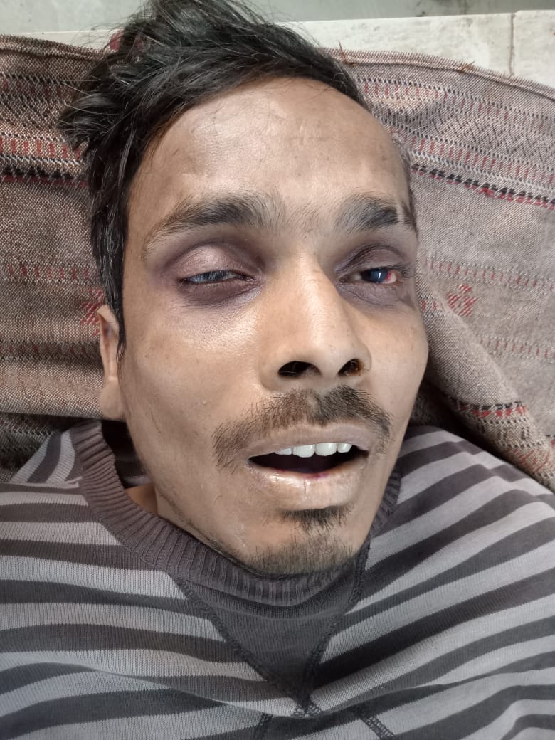 के सेवन से युवक की मौत,जांच शुरु के सेवन से युवक की मौत,जांच शुरु