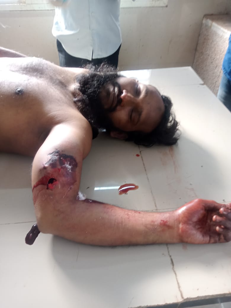 एक की मौत एक घायल एक की मौत एक घायल