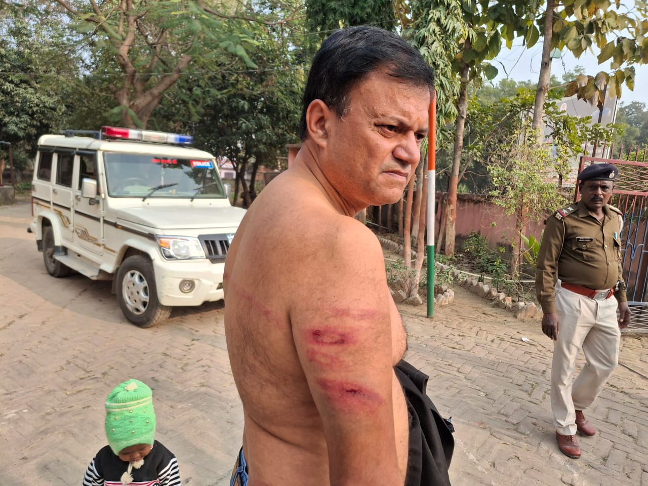 घायल रोजगार सेवक घायल रोजगार सेवक