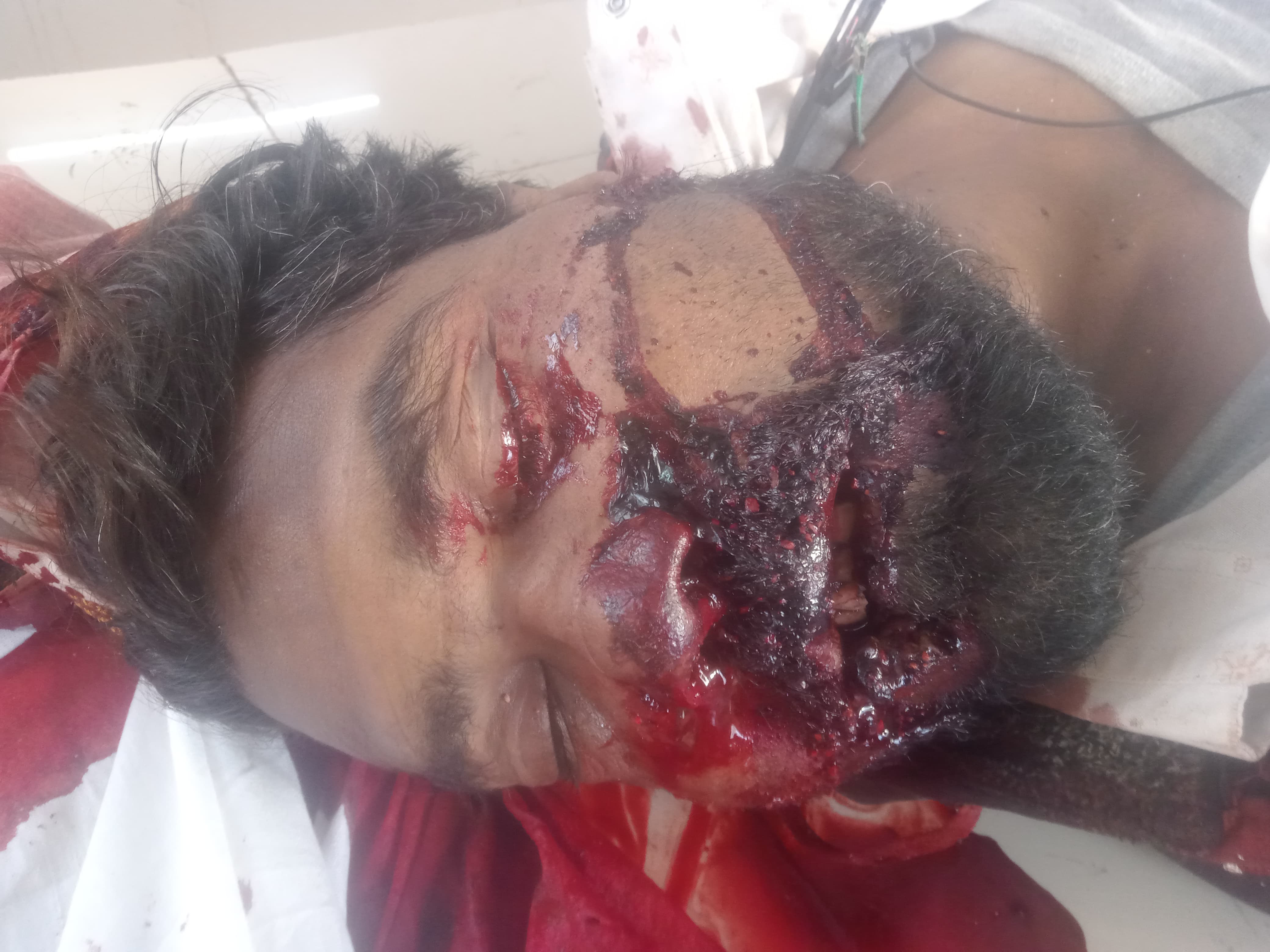 बाइक सवार एक युवक की मौत एक घायल बाइक सवार एक युवक की मौत एक घायल