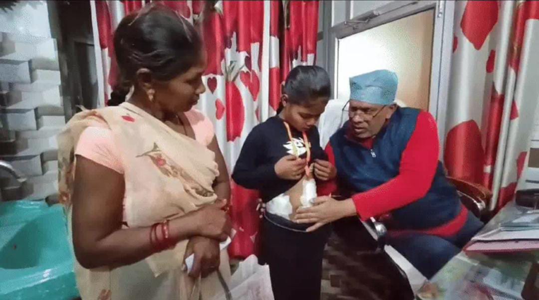 5 साल की बच्ची के पेट से निकला 250 ग्राम बाल का गुच्छा 5 साल की बच्ची के पेट से निकला 250 ग्राम बाल का गुच्छा