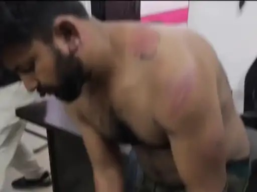घायल युवक घायल युवक