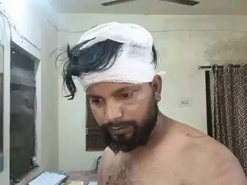 घायल युवक घायल युवक