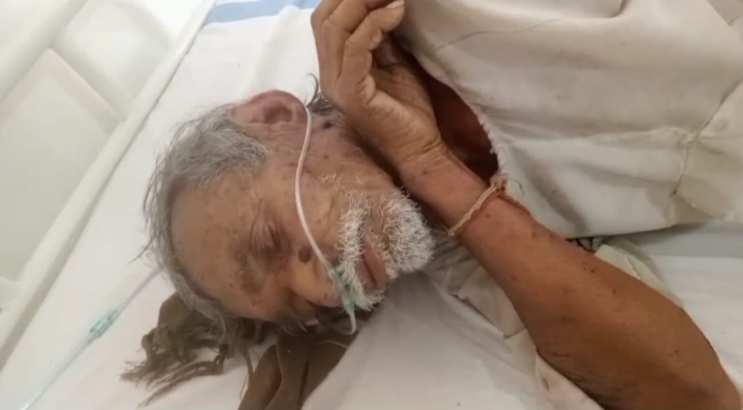 का हमला, एक की हालत गंभीर का हमला, एक की हालत गंभीर