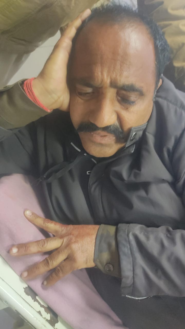 चित्तौड़गढ़ शहर के निकट हादसे में घायल हुआ परिवहन विभाग में कार्यरत निजी गार्ड। चित्तौड़गढ़ शहर के निकट हादसे में घायल हुआ परिवहन विभाग में कार्यरत निजी गार्ड।