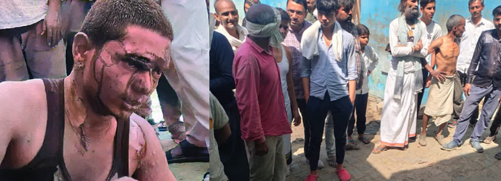 एकत्र ग्रामीण आैर इंसेट में प्रेमी अधमरा हालत में एकत्र ग्रामीण आैर इंसेट में प्रेमी अधमरा हालत में