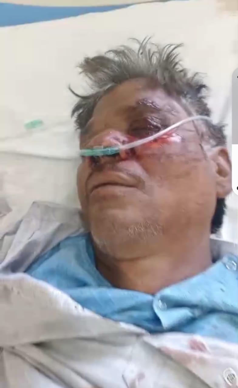 बाइक चालक घायल, हालत गंभीर बाइक चालक घायल, हालत गंभीर