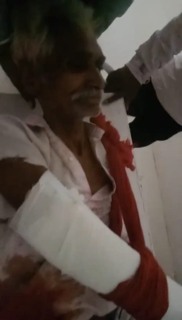 व्यक्ति पर कुल्हाड़ी से हमला,केस दर्ज व्यक्ति पर कुल्हाड़ी से हमला,केस दर्ज
