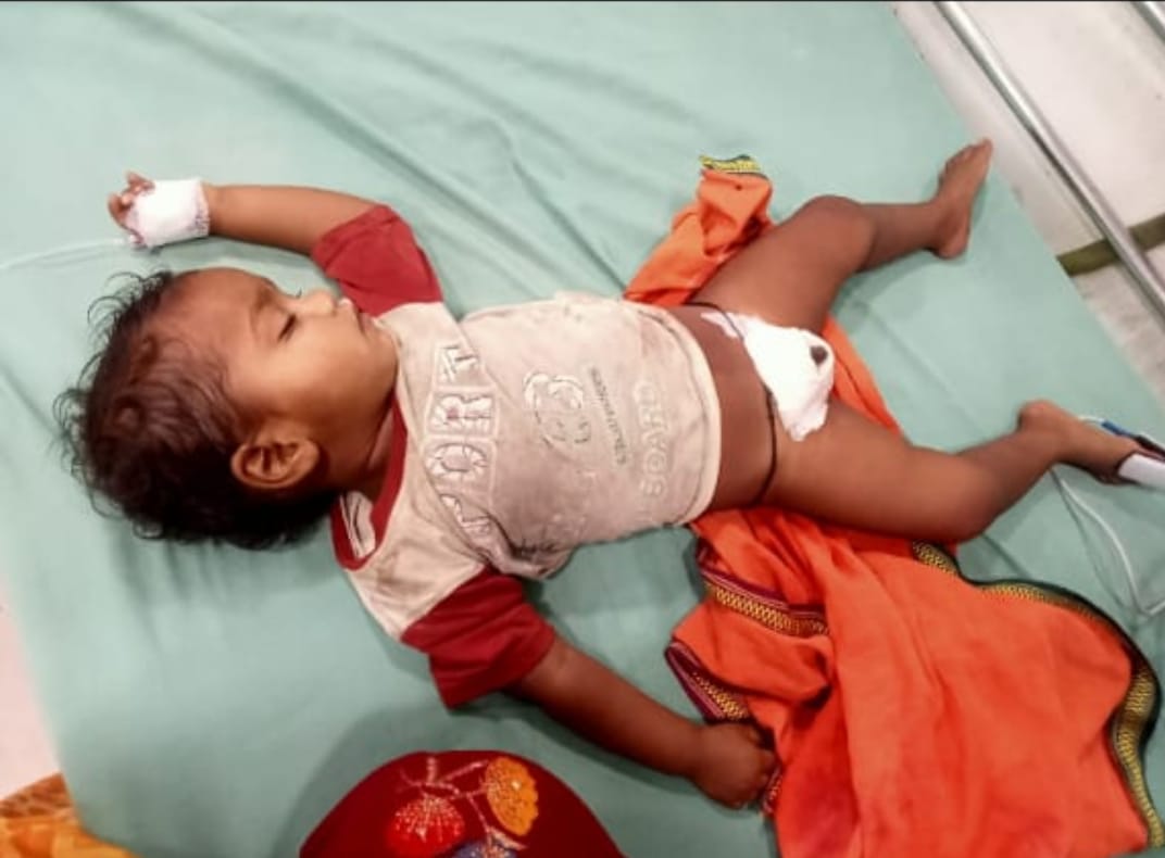 डेढ साल के अबोध का गुप्तांग काटनें से परिजनों में आक्रोश ,पुलिस मामले की जॉच में जुटी, बच्चा हॉस्पिटल में फोटो डेढ साल के अबोध का गुप्तांग काटनें से परिजनों में आक्रोश ,पुलिस मामले की जॉच में जुटी, बच्चा हॉस्पिटल में फोटो