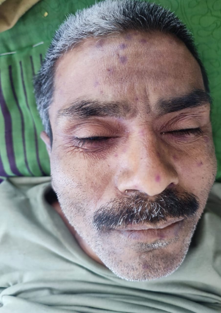 हमले से व्यक्ति की मौत हमले से व्यक्ति की मौत