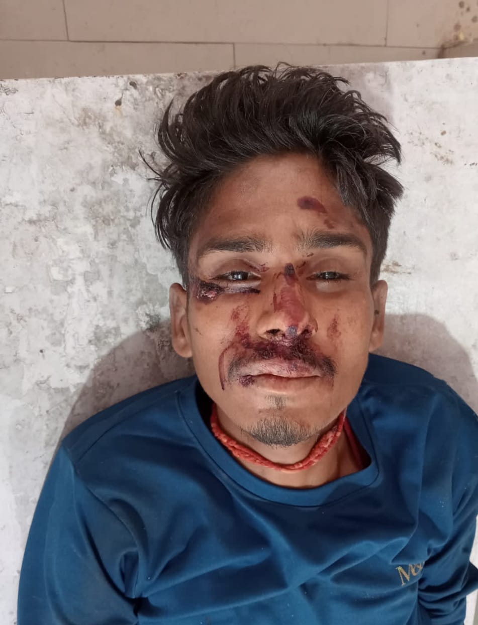 घायल अज्ञात युवक की मौत, शिनाख्त जारी घायल अज्ञात युवक की मौत, शिनाख्त जारी