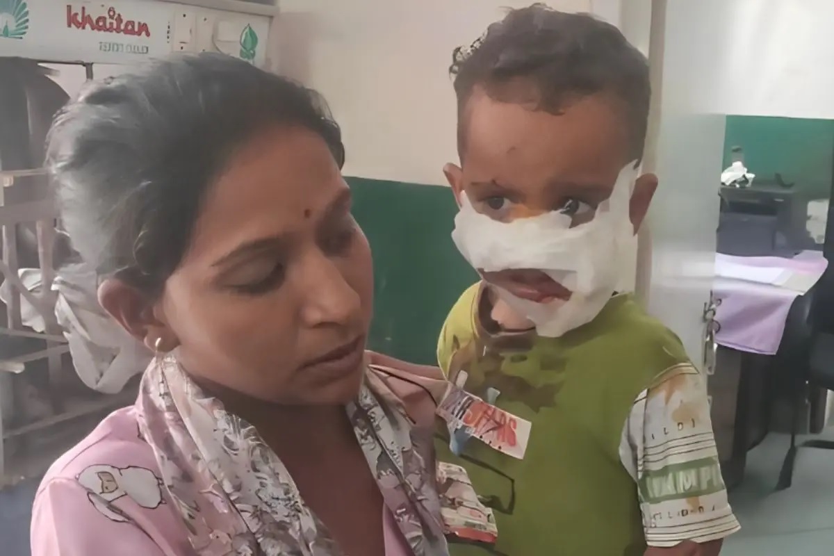 बच्ची पर कुत्ते ने हमला कर दिया। बच्ची पर कुत्ते ने हमला कर दिया।