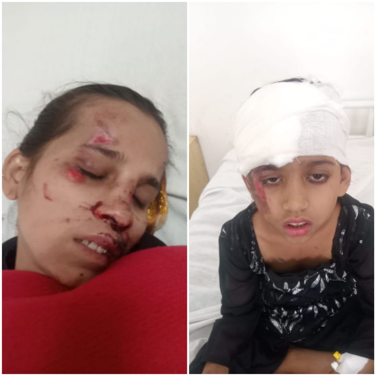 तेज रफ्तार आॅटो पलटा, मां-बेटी घायल तेज रफ्तार आॅटो पलटा, मां-बेटी घायल