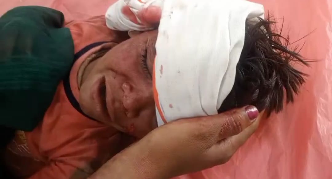 मासूम बच्ची घायल, हालत गंभीर