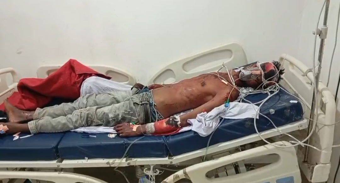 गंभीर रूप से घायल व्यक्ति