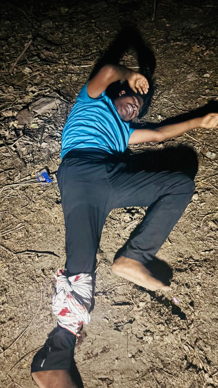 मुठभेड़ में घायल शातिर बदमाश मुठभेड़ में घायल शातिर बदमाश