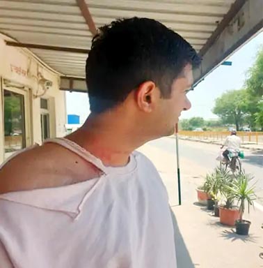 पीडि़त एडवोकेट कार्तिकेय झगड़े में लगी चोट को दिखाता हुआ। पीडि़त एडवोकेट कार्तिकेय झगड़े में लगी चोट को दिखाता हुआ।