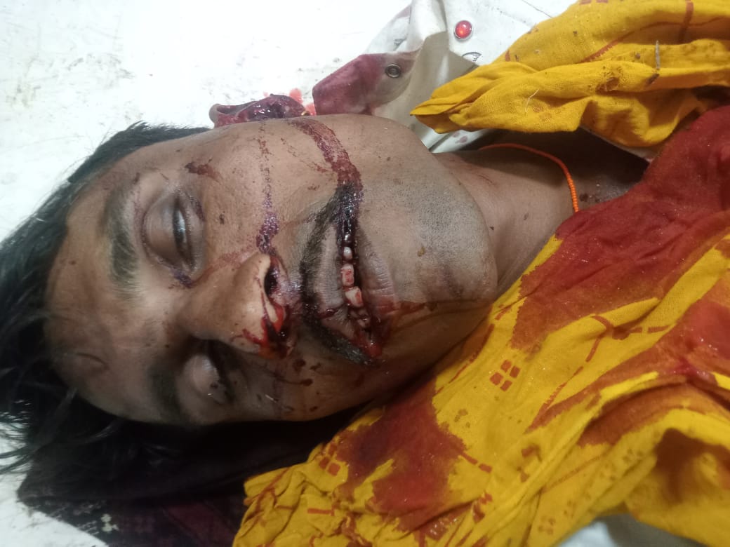 युवक की मौत,बहन सहित पांच घायल युवक की मौत,बहन सहित पांच घायल