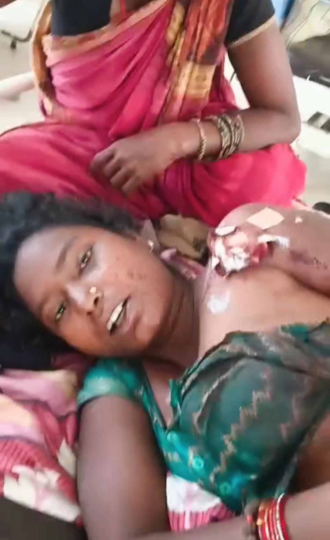 अररिया फोटो:पूर्णिया में गोली लगने से घायल विवाहिता अररिया फोटो:पूर्णिया में गोली लगने से घायल विवाहिता